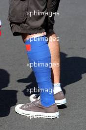 04.10.2009 Suzuka, Japan,  Timo Glock (GER), Toyota F1 Team, with his leg bandaged after his crash in qualifying - Formula 1 World Championship, Rd 15, Japanese Grand Prix, Sunday